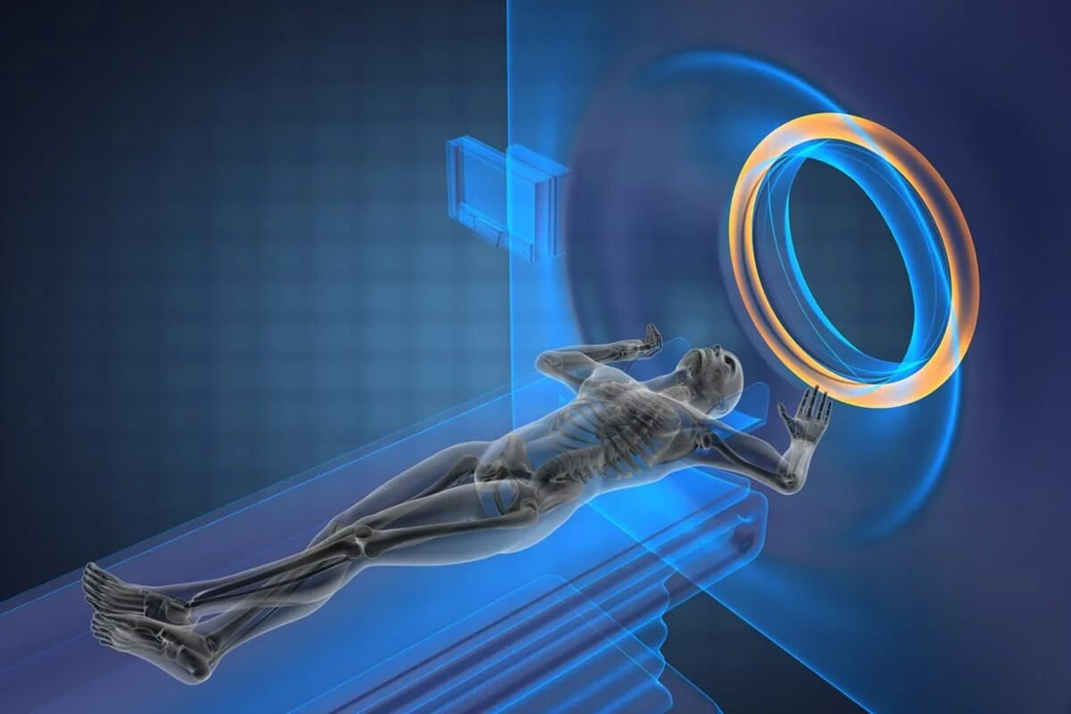 Novi PET skener omogućuje preciznije i ranije otkrivanje poremećaja mozga